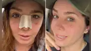 Yiddá Eslava comparte el resultado de su rinoplastia y explica por qué lo mantuvo en secreto: "Cambió mi vida"