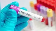 Cuáles son los síntomas del Norovirus y cómo prevenir su contagio en Estados Unidos