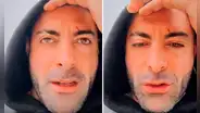 Sebastián Lizarzaburu muestra cicatrices en su rostro y conmueve con emotivo mensaje: “Días complicados”