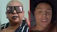 Lucía de la Cruz apoya rinoplastia de Jonathan Maicelo y lo defiende de críticas: “Con el arreglo se le va a ver mejor”