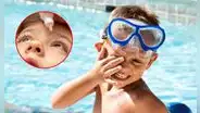 ¿Por qué la conjuntivitis es más frecuente en verano? Descubre las causas, cuánto dura y cómo curarla, según especialistas