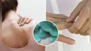 Esta es la planta común que ayuda a tratar la artrosis y los dolores musculares: todos la tenemos en casa