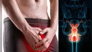 Casos de cáncer de pene aumentan en el mundo: estos son sus síntomas y así se puede prevenir, según expertos