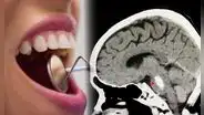 Científicos descubren que las bacterias que habitan en la boca podrían afectar a nuestro cerebro