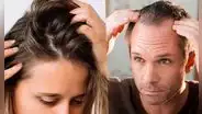 ¿Se te cae mucho el cabello? Estos son los alimentos que necesitas comer para fortalecerlo, según expertos