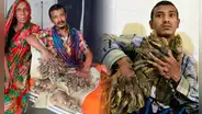 La extraña enfermedad de Abul Bajandar, el 'hombre árbol' que lleva más de 10 años con extremidades de verrugas