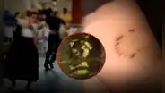 Bailaba marinera y ahora no puede moverse: perro ataca en la pierna a niña de 11 años en SMP