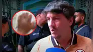 Jean Ferrari muestra fuerte imagen de cómo quedó la mano de Rodrigo Ureña tras el Universitario vs Boys: "Esto no se debe permitir"