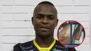 Conmoción en el fútbol colombiano: Brandon Caicedo, jugador de Deportes Quindío, fue apuñalado por barristas del club