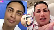 Jonathan Maicelo se somete a nuevos retoques en su rostro y sorprende a gemelo 'Paletazo': "¿Qué es eso, mi amor?"