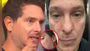Cristian Rivero revela extraña reacción en su rostro que afecta su salud: “Los nervios existen”