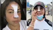 Dayanita explica por qué se operó la nariz tras polémica por quemar cráneo humano: "No podía respirar bien"