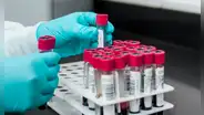 Escándalo en Reino Unido: 400.000 personas expuestas a hepatitis por transfusiones de sangre contaminada