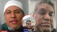 Ingeniero peruano denuncia agresión xenófoba en Chile y paramédicos se niegan a atenderlo a tiempo: "Me dijeron que no podían intervenir"