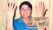 El curioso caso de Donato Cervantes, el peruano que iba a ser amputado del brazo, pero afirmó haber sido curado por extraterrestres