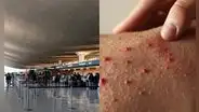 Funcionario de salud de Washington alerta sobre caso de un viajero con sarampión en aeropuerto de Dulles