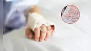 Extraen 142 lombrices intestinales a niño en México: lo operaron de emergencia tras dos días de dolores abdominales