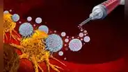 La inmunoterapia en etapas tempranas del cáncer mejora la supervivencia y cambia el enfoque del tratamiento oncológico, según estudios científicos