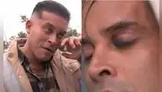 Christian Domínguez sorprende al reaparecer con el ojo morado tras ausentarse de su programa: “Jugué muy fuerte”