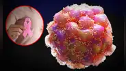 Científicos españoles identifican la proteína que ayuda a las células cancerosas a expandirse a otros órganos: "Son capaces de evadir el sistema inmune"