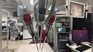 Con entrenamientos de videos y ChatGPT, un robot marca hito en la medicina al extirpar una vesícula sin ayuda humana