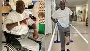 Un hombre en Londres se hizo la pedicura y terminó perdiendo la pierna: tenía una enfermedad crónica