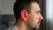 ¿Por qué tu oreja se pone roja y se calienta? Esta es la verdadera razón del enrojecimiento, según especialista