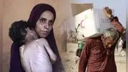 “Es una crisis moral”: secretario de la ONU critica indiferencia de la comunidad internacional por muertes en Gaza