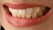 Científicos en Inglaterra descubren un nuevo tratamiento que permite regenerar naturalmente los dientes en adultos