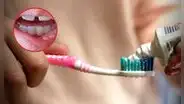 ¿Qué es el fluoruro de estaño y por qué el Digemid lo calificó de riesgoso? Está presente en la pasta Colgate Total Clean Mint y en 13 cremas más