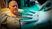 Un implante cerebral permite a un hombre sentir alegría tras más de 30 años de depresión severa