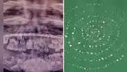 El insólito caso del menor que tenía 526 dientes en la mandíbula y se los extrajeron en una sola cirugía en la India