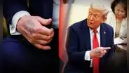 Trump aparece con moretones en las manos y genera preocupación por su estado de salud: ¿qué dicen los médicos?