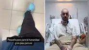 'Furrey' vuelve a caminar sin dolor tras permanecer varios días en UCI, youtuber español se graba yendo al mercado: "Es un gran paso para mí"