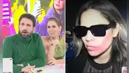 ‘Peluchín’ consternado tras notar extraño detalle en los rostros de Andrea San Martín y Yerko en concierto: “¿Qué le pasó en la cara?"