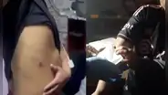 "Me persiguieron y apuntaron": joven relató cómo la PNP entró disparando a Comunidad Cantagallo