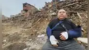 Hombre se fractura ambas muñecas al salvar a su perro y gato de incendio en Pamplona Alta: "Solo pude tirarme"