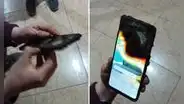 Mujer colombiana deja su celular cargando junto a su cabeza, explota y termina con el rostro desfigurado