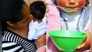 Anemia en el Perú: la emergencia silenciosa reflejo de la pobreza y el abandono estatal