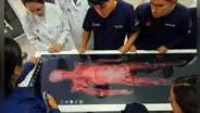 UCV apuesta por la innovación médica e implementa laboratorio con disección virtual en Los Olivos