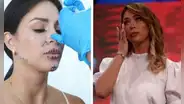 Sheyla Rojas evalúa revertir sus procedimientos estéticos: "Me había puesto tanto ácido hialurónico"