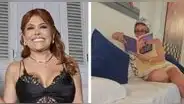 Magaly Medina comparte sin filtros su proceso de recuperación tras cirugía facial: “Mostrándoles orgullosamente mis moretones”
