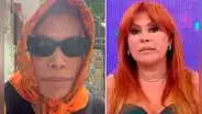 Magaly Medina no volverá a la TV hasta recuperarse de su cirugía facial: "No puedo poner a este rostro 2 kilos de maquillaje"