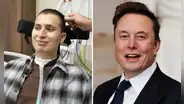 Joven parapléjico integra primer ensayo del chip cerebral de Elon Musk en Reino Unido y revela cómo cambió su vida