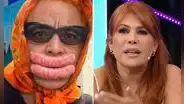 Jorge Benavides se pronuncia sobre reacción de Magaly Medina por parodiar su cirugía estética: "A la señora no le ha gustado mucho"