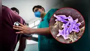 Falta de medicinas expone a pacientes con TBC resistente a graves secuelas