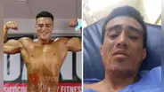 Taxista atropella y deja grave a campeón fisicoculturista en San Miguel: chofer está libre y no asume gastos, según familiares