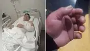 Agente de la ATU agredido con un martillo en el Metropolitano por pasajero denuncia falta de apoyo y la no renovación de su contrato: "Me abandonaron a mi suerte"