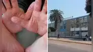 Suspenden clases presenciales en colegio de Lince por contagio de virus Coxsackie que afecta manos, pies y boca en alumnos