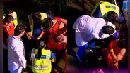 Famoso chico reality se somete a delicada operación tras fuerte accidente en ‘Esto es guerra’ e impacta al mostrar su cicatriz: “Resistiré”